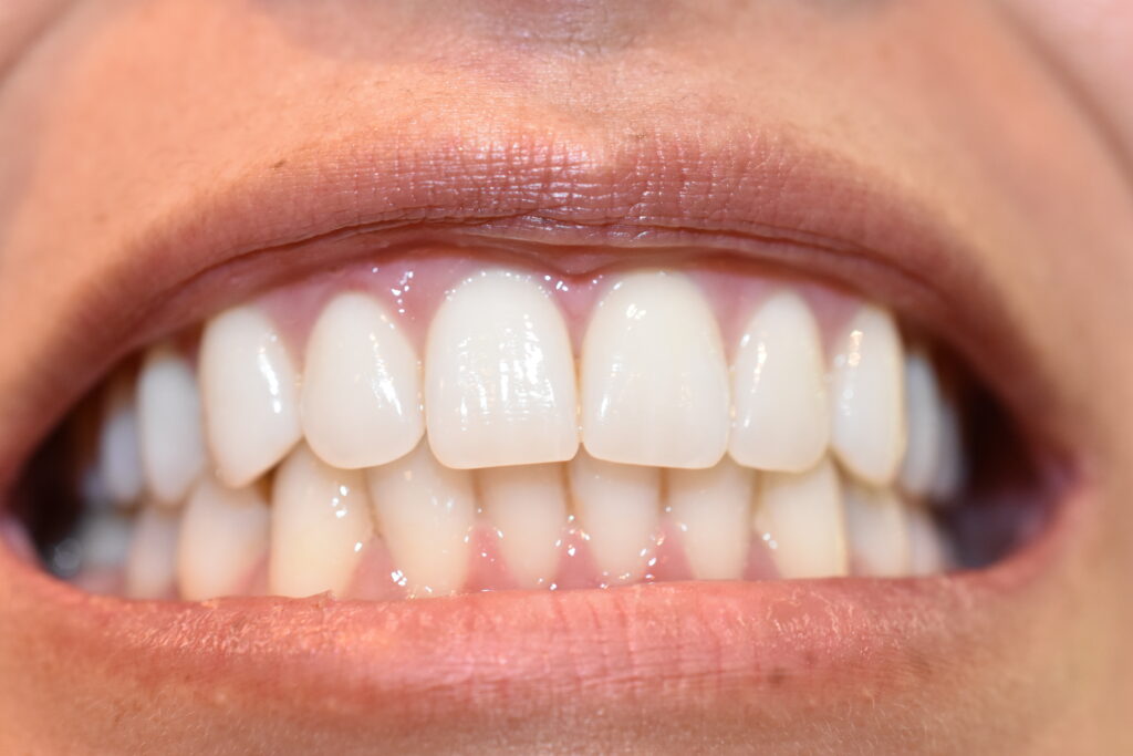 Eine Makroaufnahme eines Mundes mit perfekten weißen Zähnen. Person lächelt. Frau mit gesunden roten Lippen